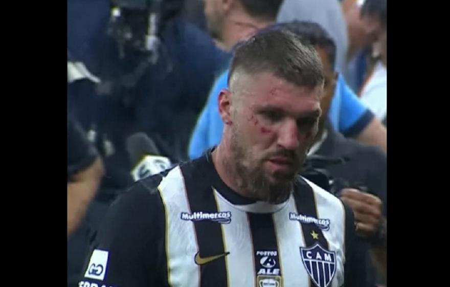 Ο Λιάνκο χτυπήθηκε από 7 διαφορετικούς αντιπάλους του στα απίστευτα επεισόδια στη Βραζιλία!