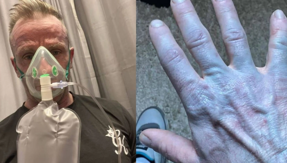 Ξύπνησε και ήταν όλος μπλε: Όταν πήγε στο νοσοκομείο οι γιατροί έκλαψαν από τα γέλια