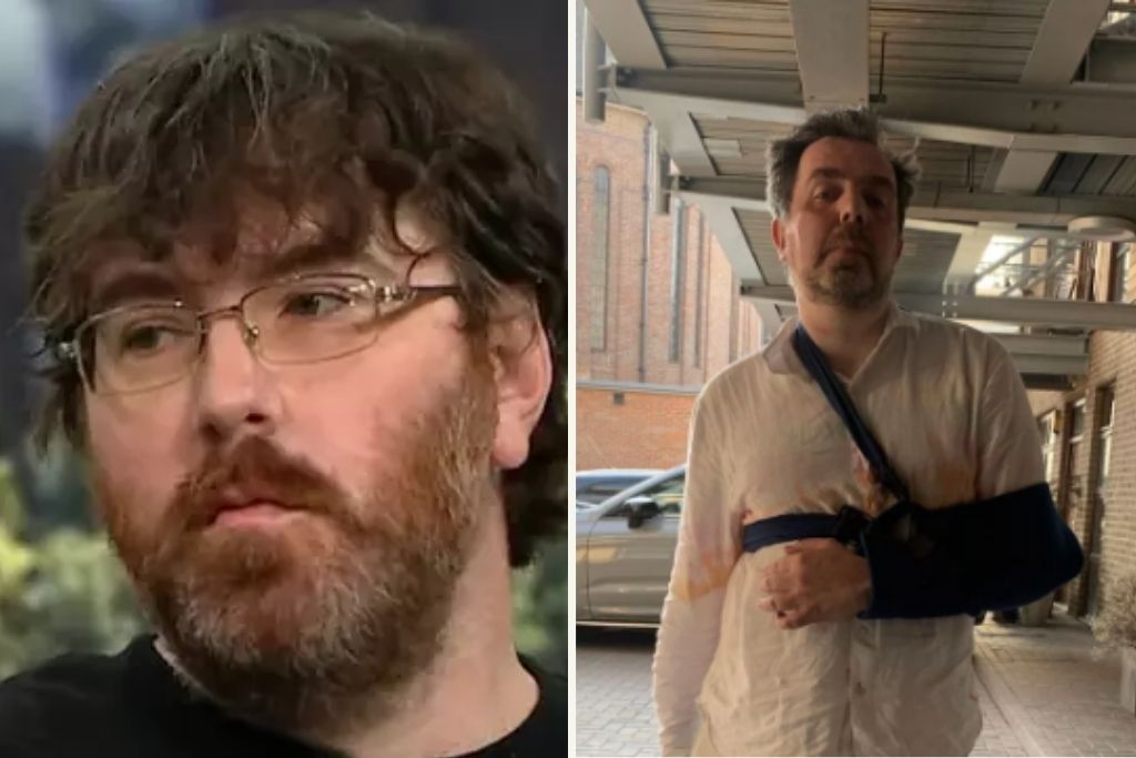 Δύο άνδρες με το μικρότερο και το μεγαλύτερο ανδρικό μόριο στον κόσμο μιλούν για τις δυσκολίες που αντιμετωπίζουν: «Είναι κατάρα»