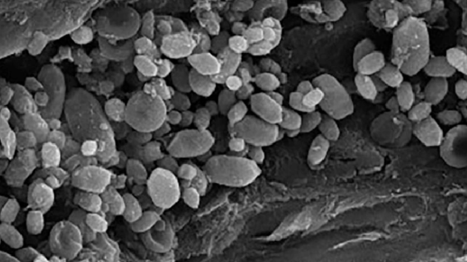 Οι πέτρες στο αυτί μας ρυθμίζουν την ισορροπία: Τι είναι η ωτοκονία