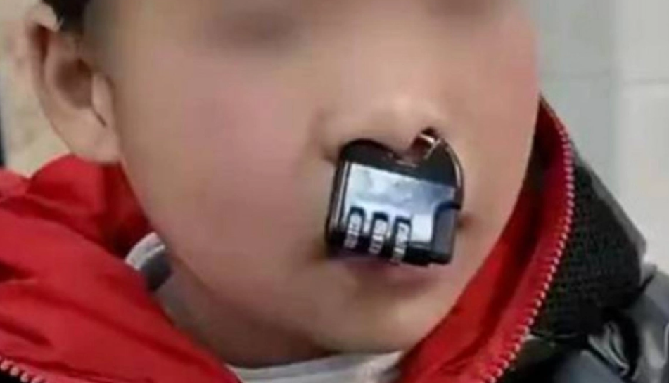 Αγόρι σφήνωσε λουκέτο στη μύτη του και χρειάστηκε επέμβαση πυροσβεστών για την αφαίρεση 