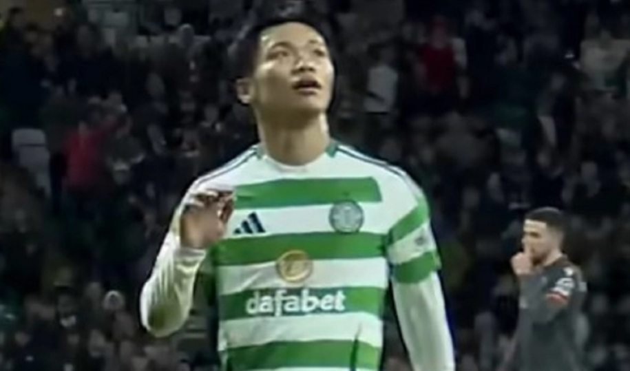 Ζέσταμα με τα... μάτια: Η ιδιαίτερη προθέρμανση του Χατάτε της Σέλτικ που δημιούργησε ερωτηματικά (ΒΙΝΤΕΟ)