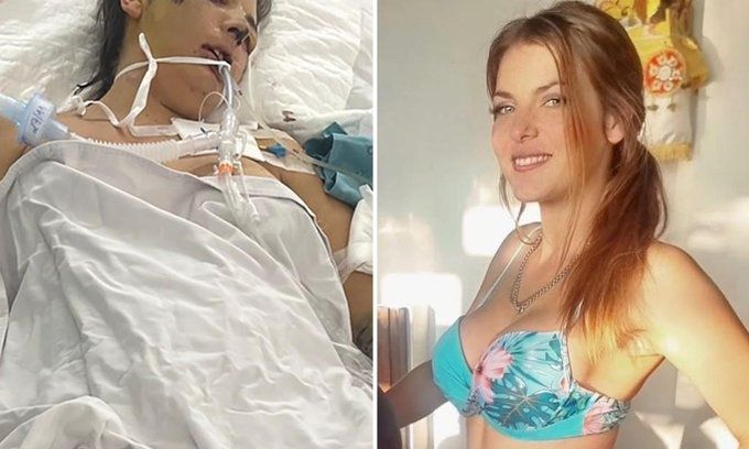 Χαροπαλεύει 31χρονη μητέρα τριών παιδιών μετά από επέμβαση αισθητικής στο Βιετνάμ